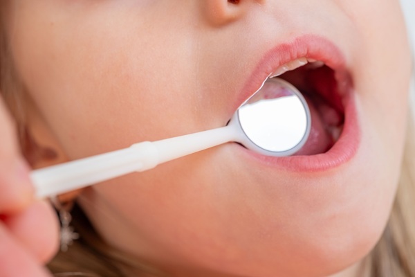 Understanding Infant Frenectomy: What Parents Need To Know