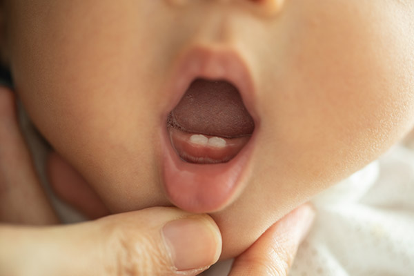 Oral Hygiene Tips from a Pediatric Dentist for Your Infant’s First Teeth from Parkside Pediatric Dentists in Concord, CA