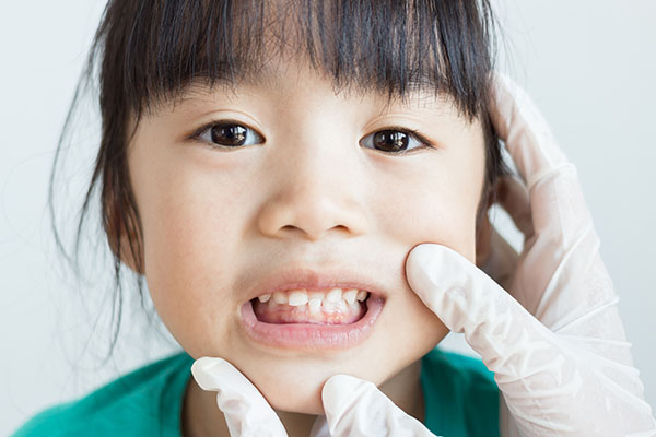 Pediatric Dental Health Benefits of Drinking Water from Parkside Pediatric Dentists in Concord, CA